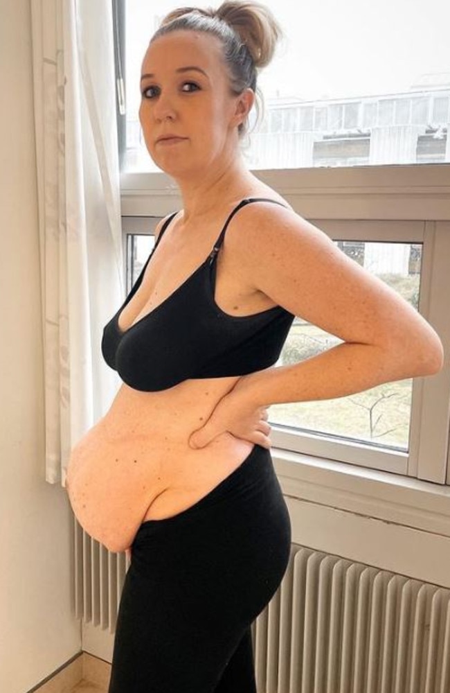 Michella also shared a photo of her postpartum stomach on Instagram. Picture: Instagram/@filippaophelia. .