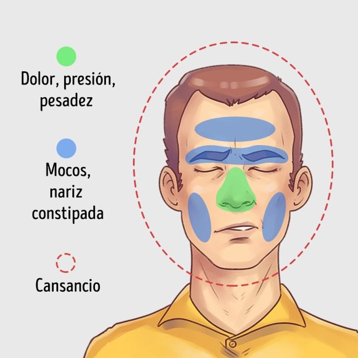 5 Tipos de dolor de cabeza y cómo aliviarlos rápidamente