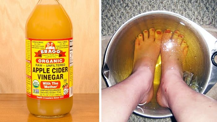 Beneficios del vinagre. Deja sumergir los pies en vinagre por 15 minutos